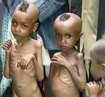 Genocide, Looting and Ethnocracy are the Causes of Famine in Ethiopia